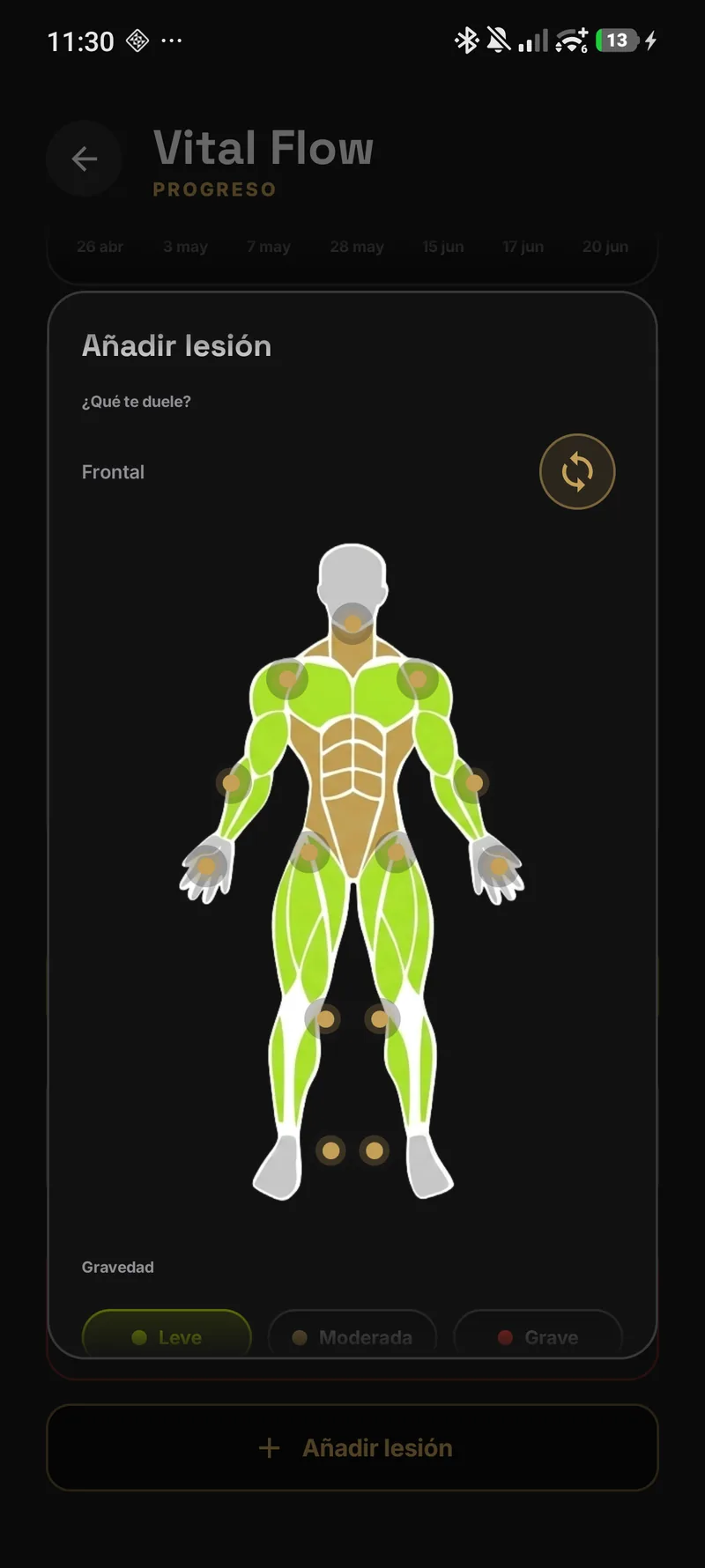 Pantalla de SafeTrack: un mapa corporal frontal con los grupos musculares en verde y puntos seleccionables sobre las articulaciones para registrar dónde duele, con tres niveles de gravedad.